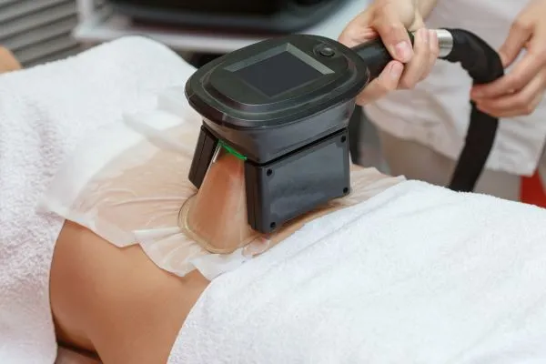 Image of person having fat freezing treatment to help weight gain Bishops Stortford