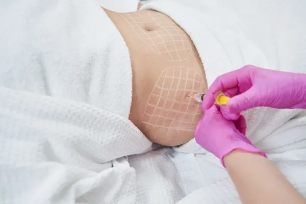 image of fat dissolving injections on love handles to help combat weight gain Bishops Stortford