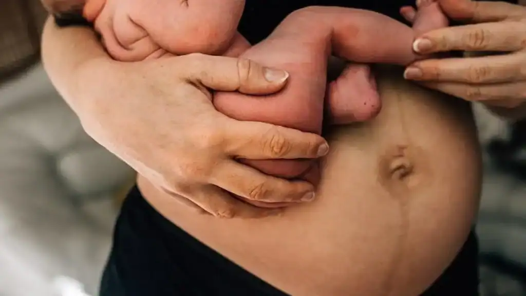 Why Is My Stomach Still Big After Pregnancy Bishops Stortford?